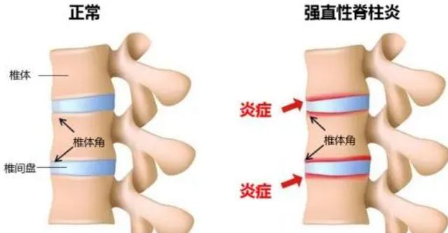 “中国第一蛇村”：300万条蛇与人同吃同住，蛇王靠它年收入千万