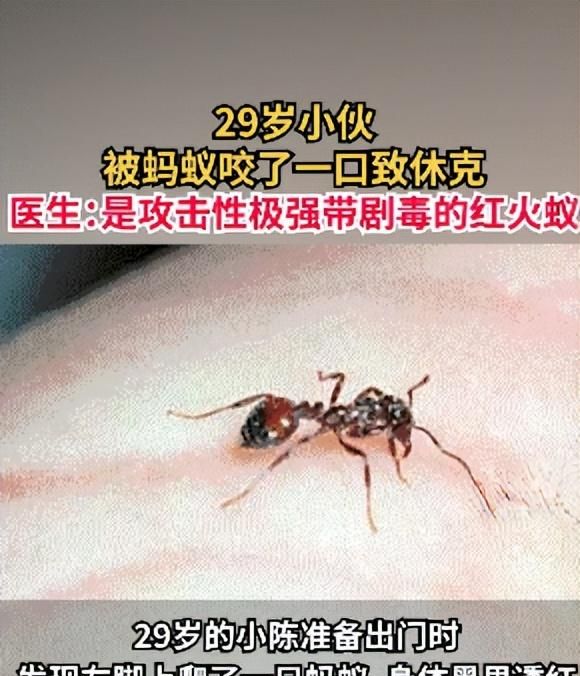 29岁小伙被蚂蚁咬了一口休克入院，医生：这是带剧毒的红火蚁，甚至可导致死亡