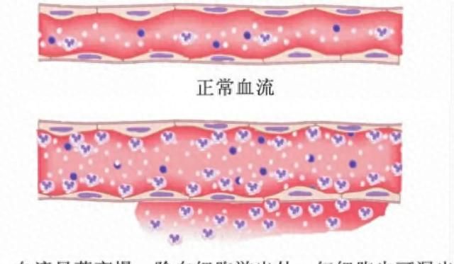 根据原理，防治新冠，新冠病毒你了解几何？