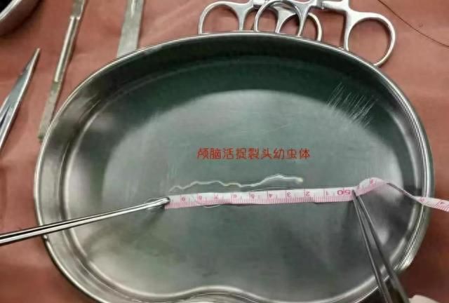 女子宰杀活鱼从腹中掏出一把“面条”，白色细条状：我都不知道那是啥，那个鱼里面没有肠子