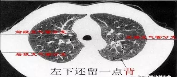 最详尽的图文解说：肺的分段解剖
