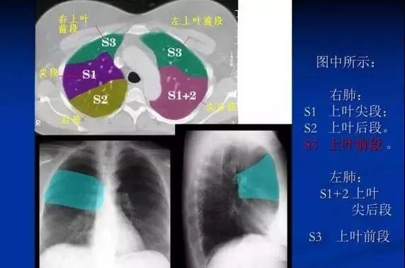 最详尽的图文解说：肺的分段解剖